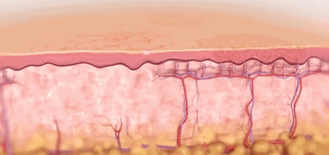 Photorejuvenation "do not step on the thunder", teach you how to repair after surgery - 配图